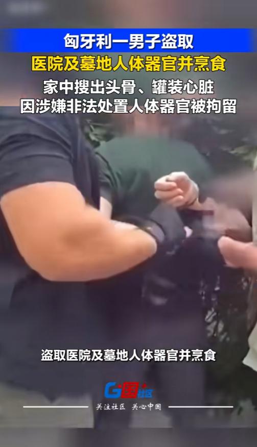 “这是真吃人啊！”当地时间6月17日，匈牙利，当地警方抓获了一名医院勤杂工。他对