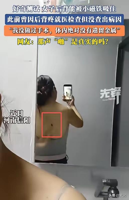 女子产后背痛能吸住磁铁？河南一名女子生完孩子后长期被后背疼痛困扰，一次无意间拿小