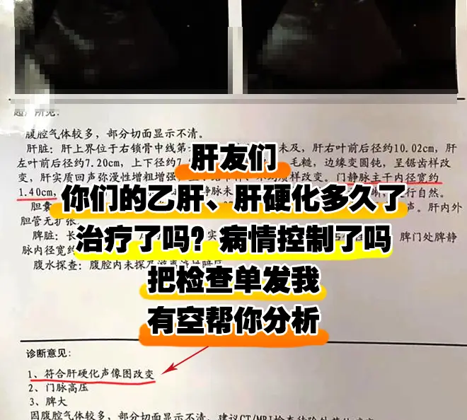 乙肝 医学科普 涨知识 肝硬化 热点宝