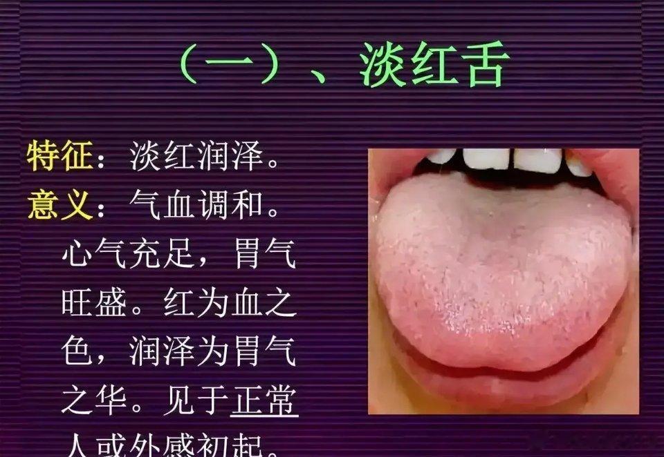 望舌知健康，最全舌诊图解，方便对照1、淡红舌——外感初起或正常人2、淡白舌——主