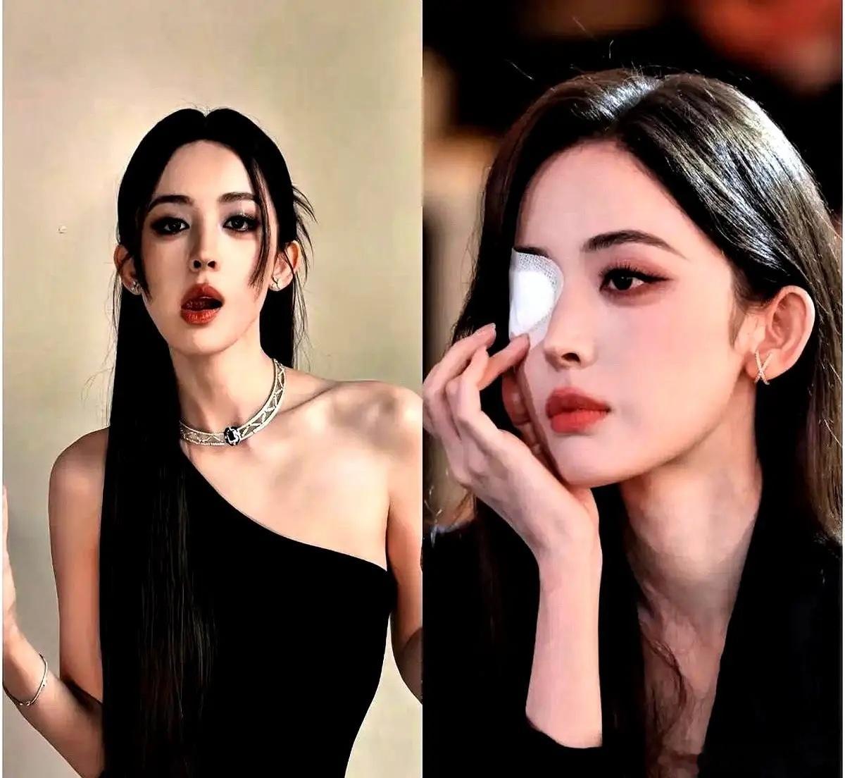 古力娜扎这事儿，有点意思。她一只眼睛发炎，又红又肿，就这么大大方方地去参加活动了