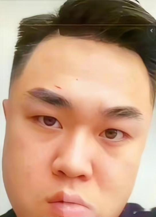 第一张照片中的这个人，和第二张照片中的这个人，是一个人吗？如果是一个人的话，面部