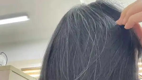 哥伦比亚大学的研究为“一夜白头”提供了科学解释。实验通过高精度影像技术发现，压力
