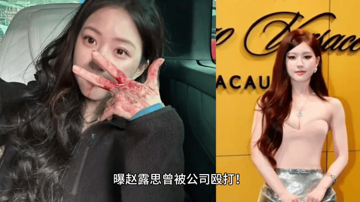 在直播里中，赵露思眼含泪水，自爆在2019年受到银河酷娱工作人员的暴力对待：由于