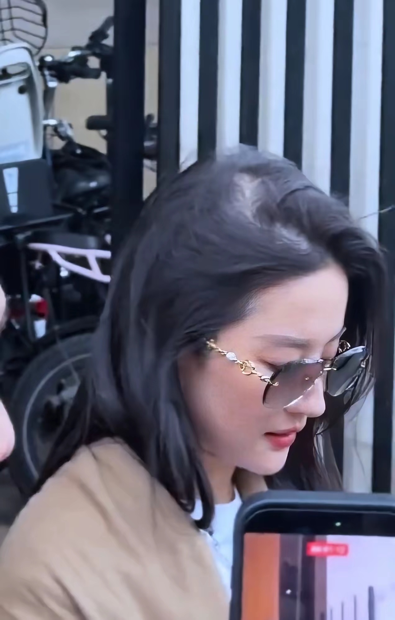 刘亦菲掉发好严重