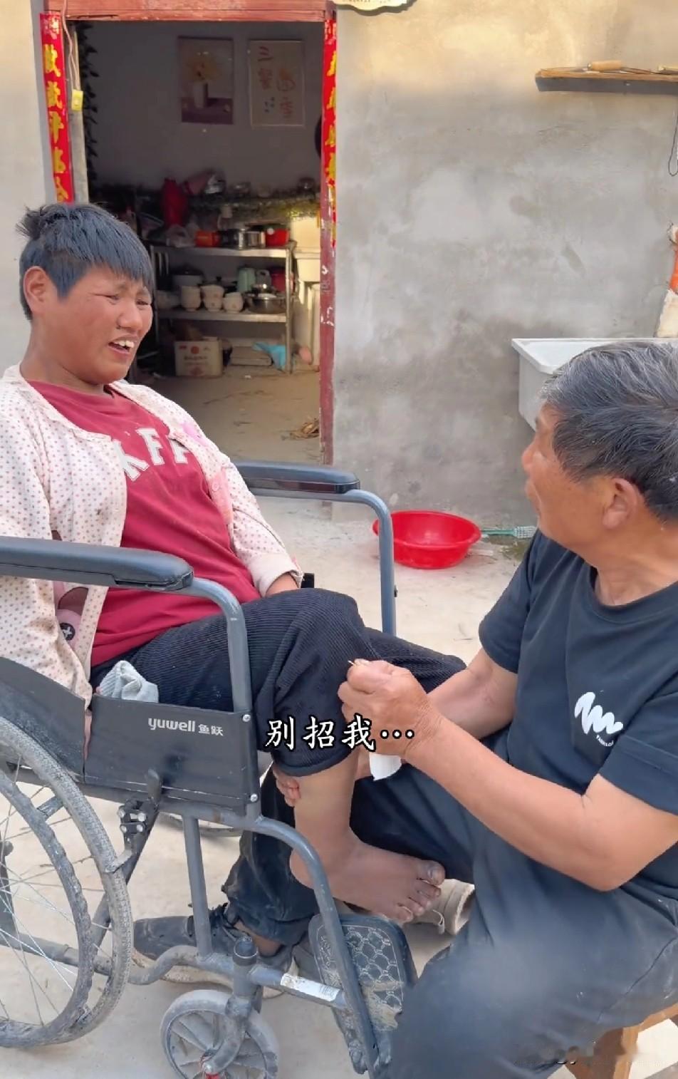 妮娃整只脚都发黑发紫，不知是因为长时间坐轮椅神经坏死，还是真的就是晒黑的