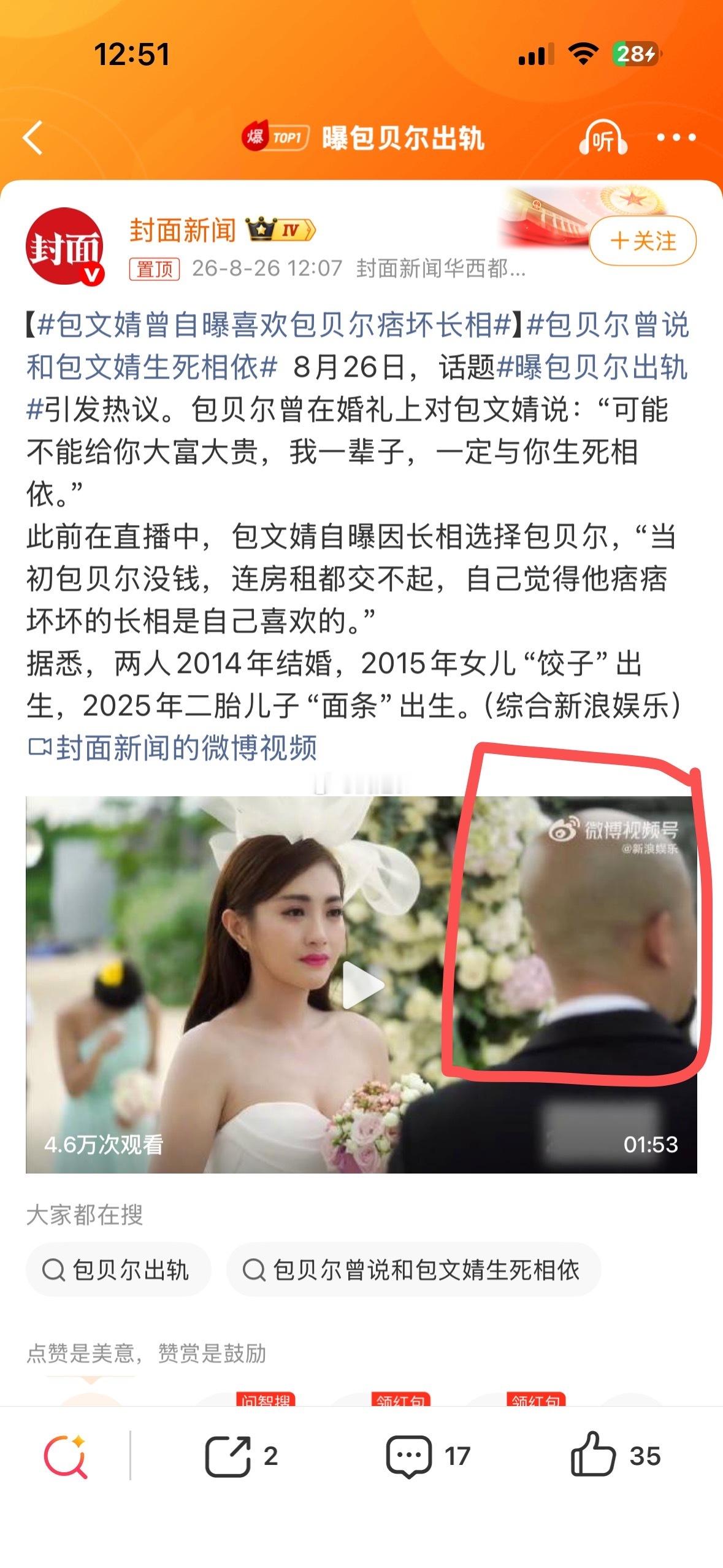 曝包贝尔出轨他一直光头造型的原因找到了 这是地中海吧 这一块看起来毛囊都没有 ​