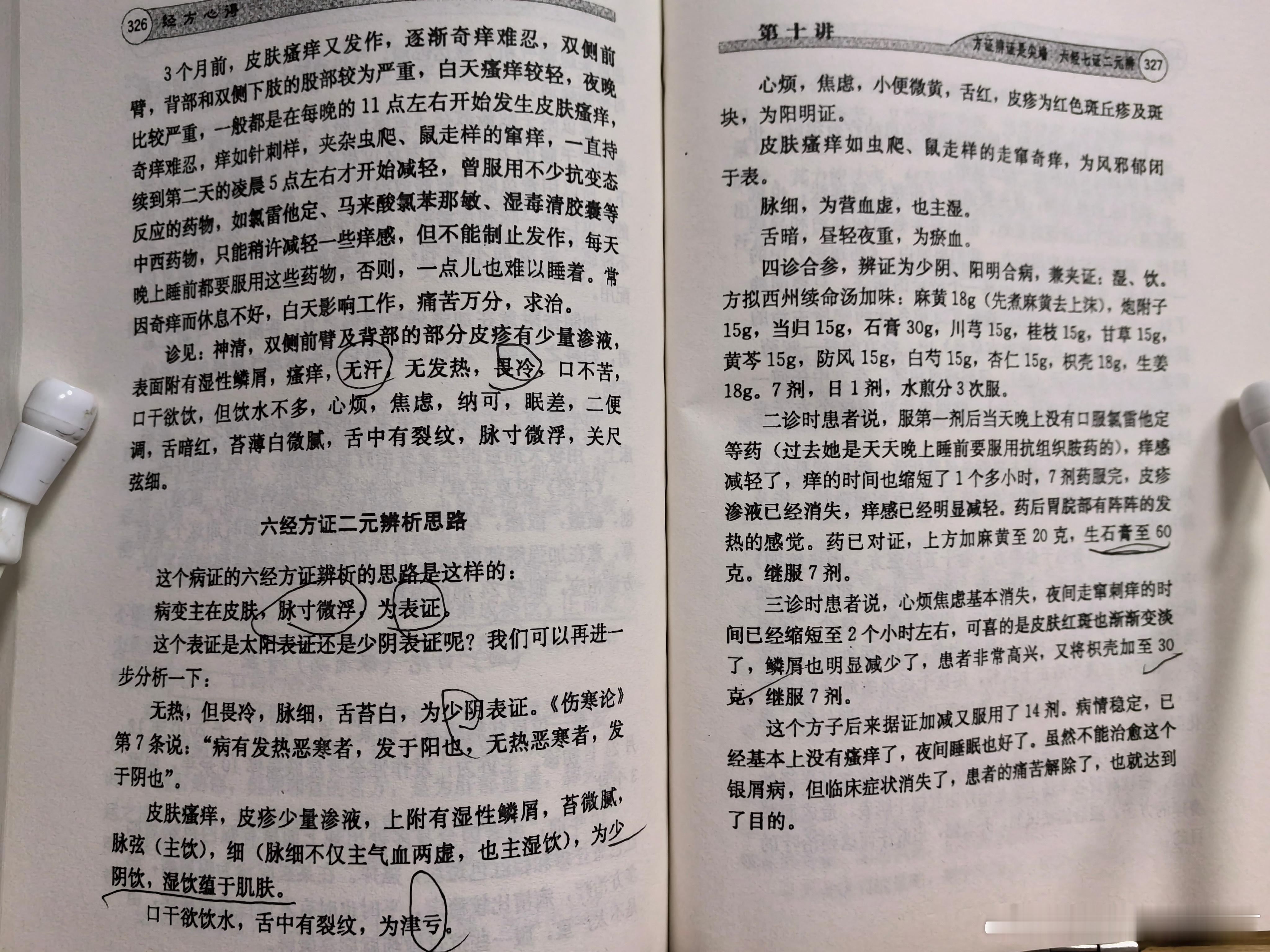 毛进军主任用西州续命汤治疗银屑病辨证细致，可师可法，六经方证的典范之作[打cal