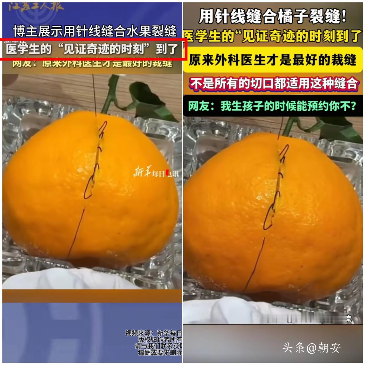 人怎么可以这么厉害！

江苏一位博主，直接用外科缝合技术给耙耙柑做起了“微创手术