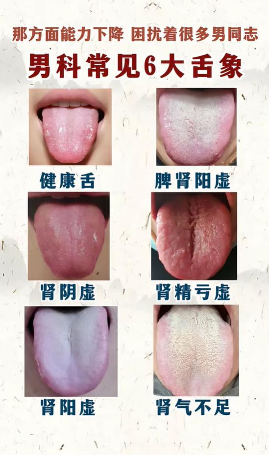 腰膝酸软、精力不足，从舌苔看肾气亏虚的信号