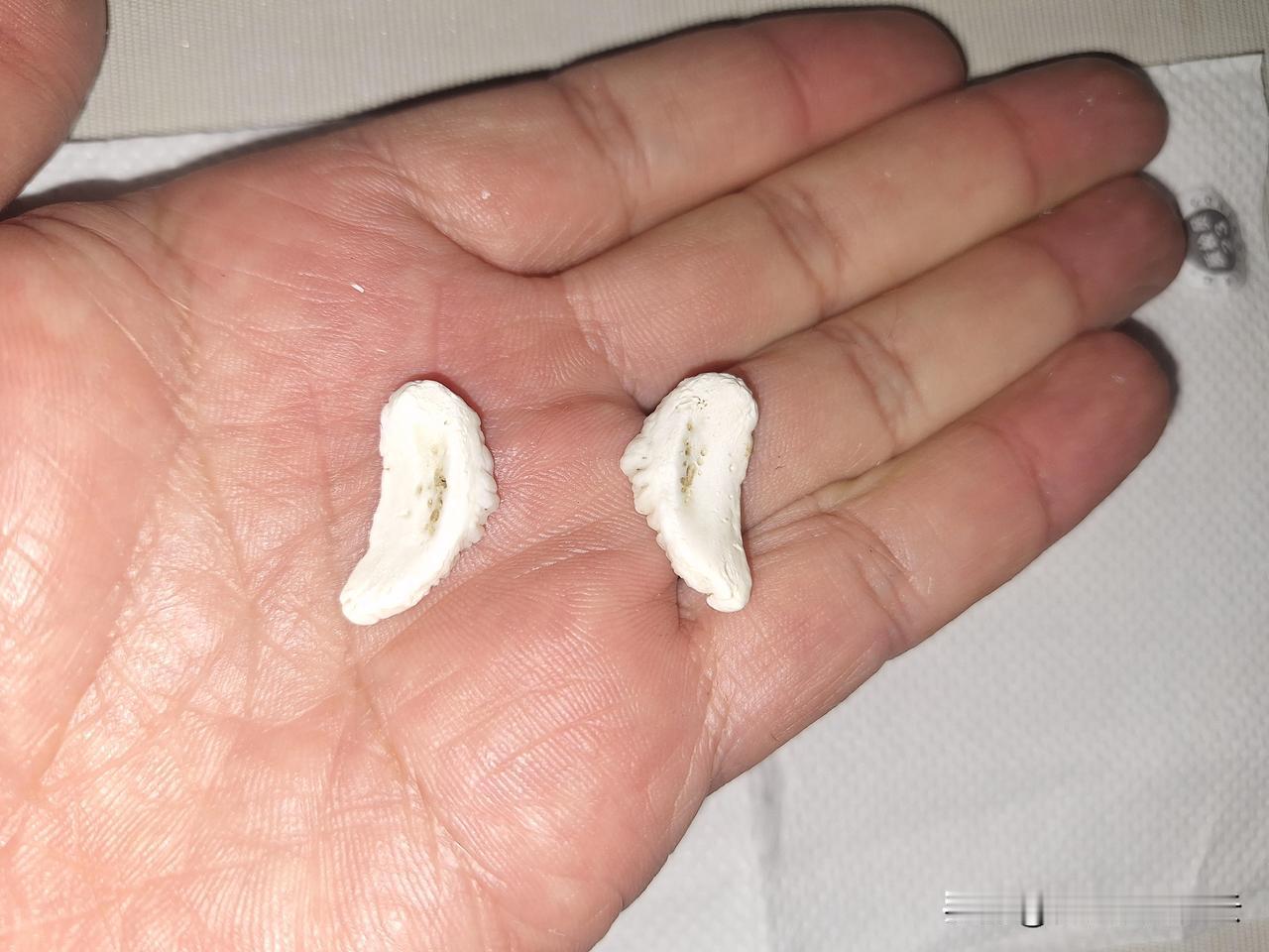 吃博斯腾湖的鱼头，吃出两颗鱼牙，正好我掉了两颗，物尽其用，镶上去。如果移植成功，