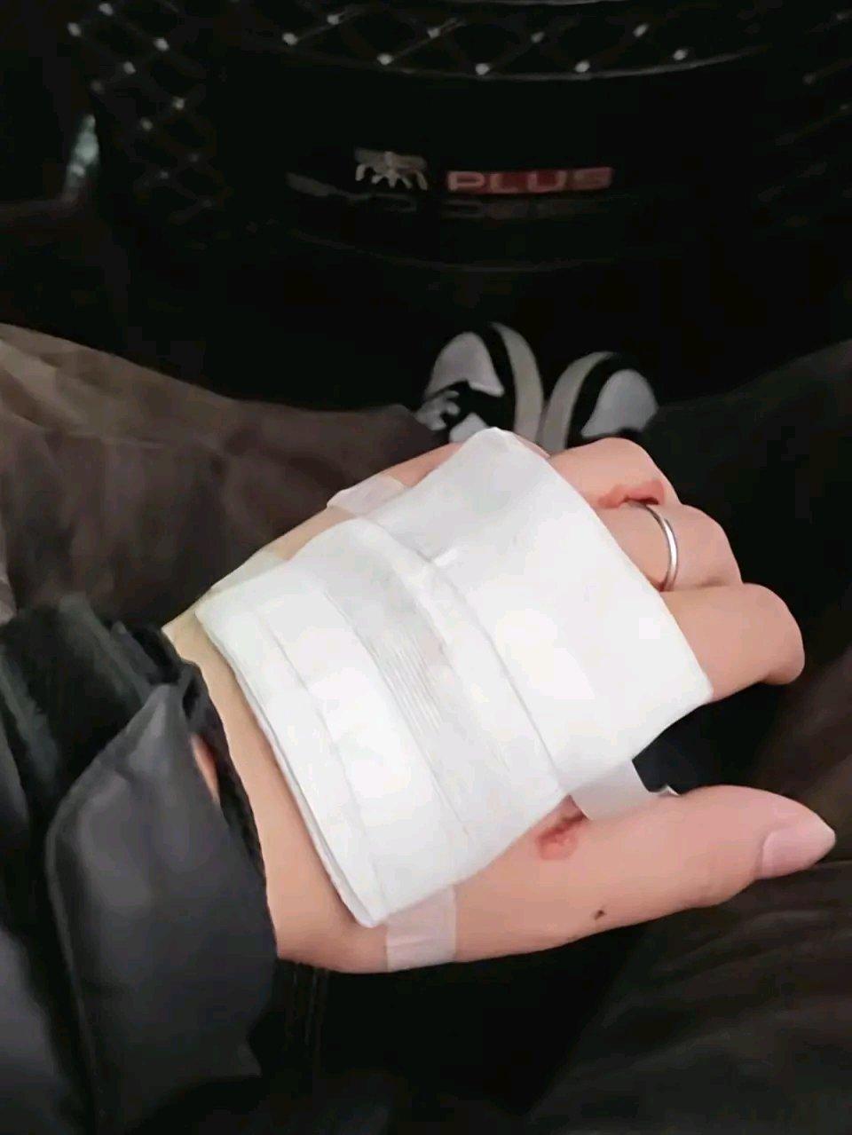 游客称在西湖边散步时被松鼠咬伤，花1300多元打狂犬疫苗，官方：正核查，建议游客