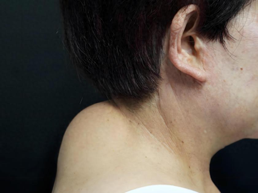 富贵包不富贵，是健康大麻烦！4 个穴位坚持按，帮你平推富贵包
内容仅供参考，如有