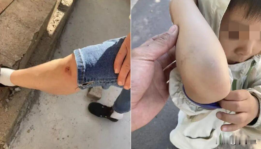 台铃电动车方向把频繁锁死，老人接孙险遭二次伤，售后难断症结

谁能想到，买辆新电