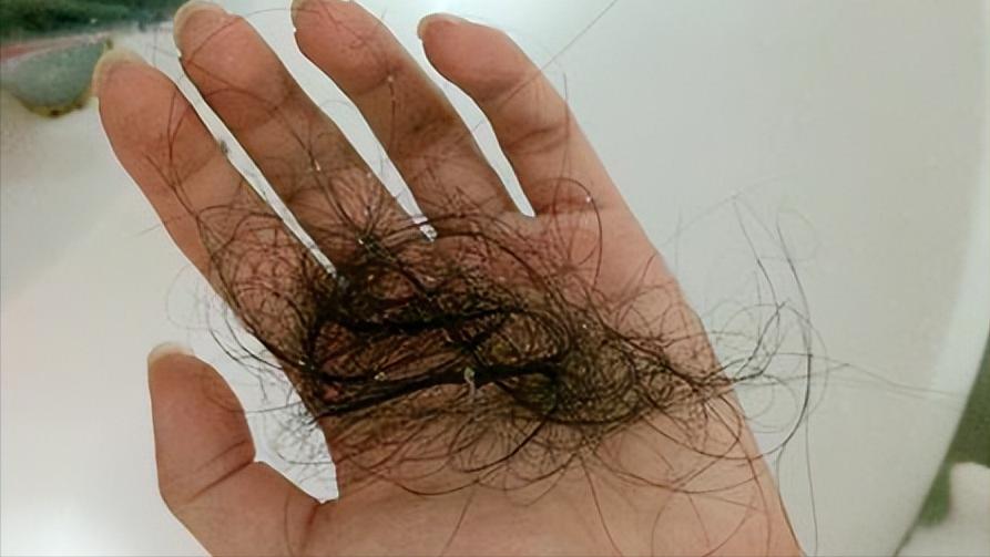 头发和体毛虽然都是由角蛋白组成的“毛”，但它们的生长方式和生命周期却大不相同，这