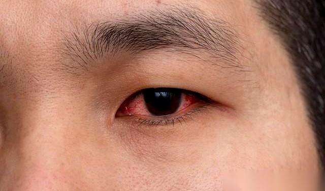 眼睛里突然多了几个小黑影，飘来飘去。
你甩甩头，以为是飞蚊症，是最近累着了。
但