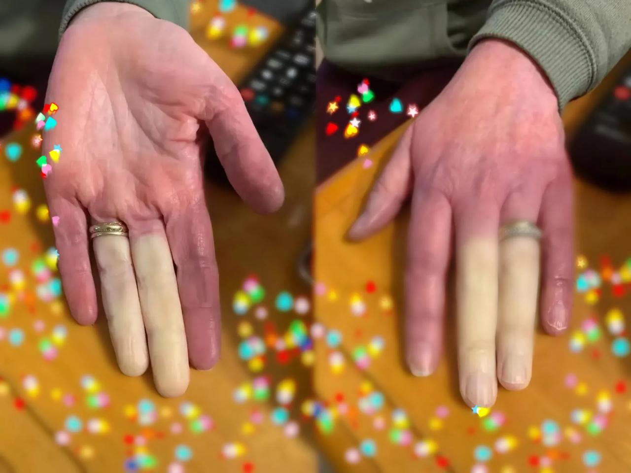 朋友上班的时候不小心睡着了？醒来的时候就已经这样了？他这个手怎么了？朋友说他最近