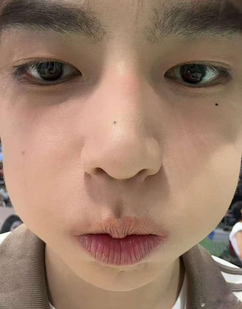 章昊怼脸照章昊公开怼脸照章昊公开怼脸照，好萌， ​​​