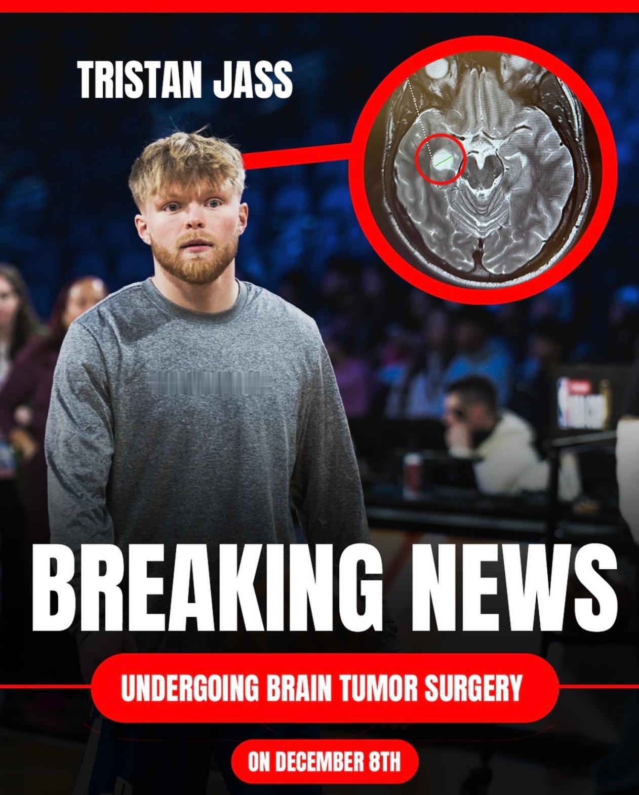 早日康复！美国知名篮球网红TRISTAN JASS因6年前长了一个肿瘤做了开颅手