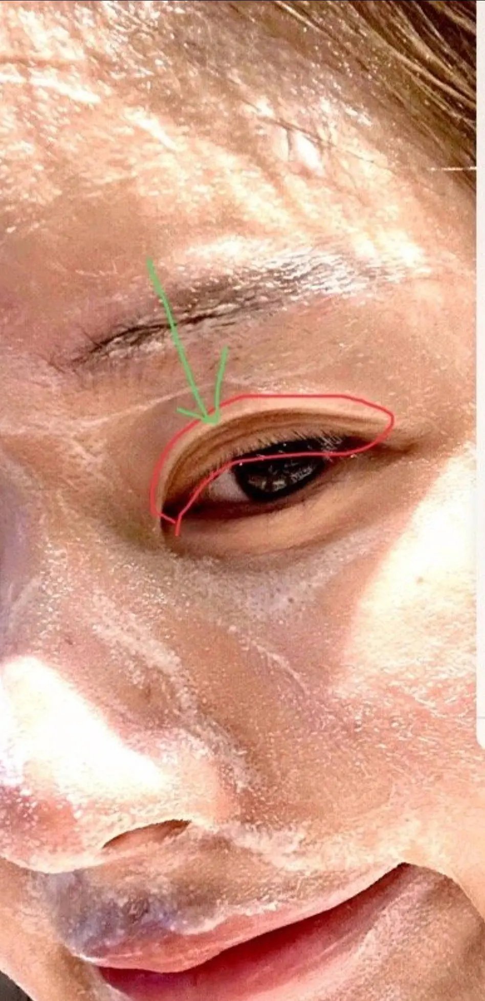 来欣赏露思的立体双眼皮 ​​​