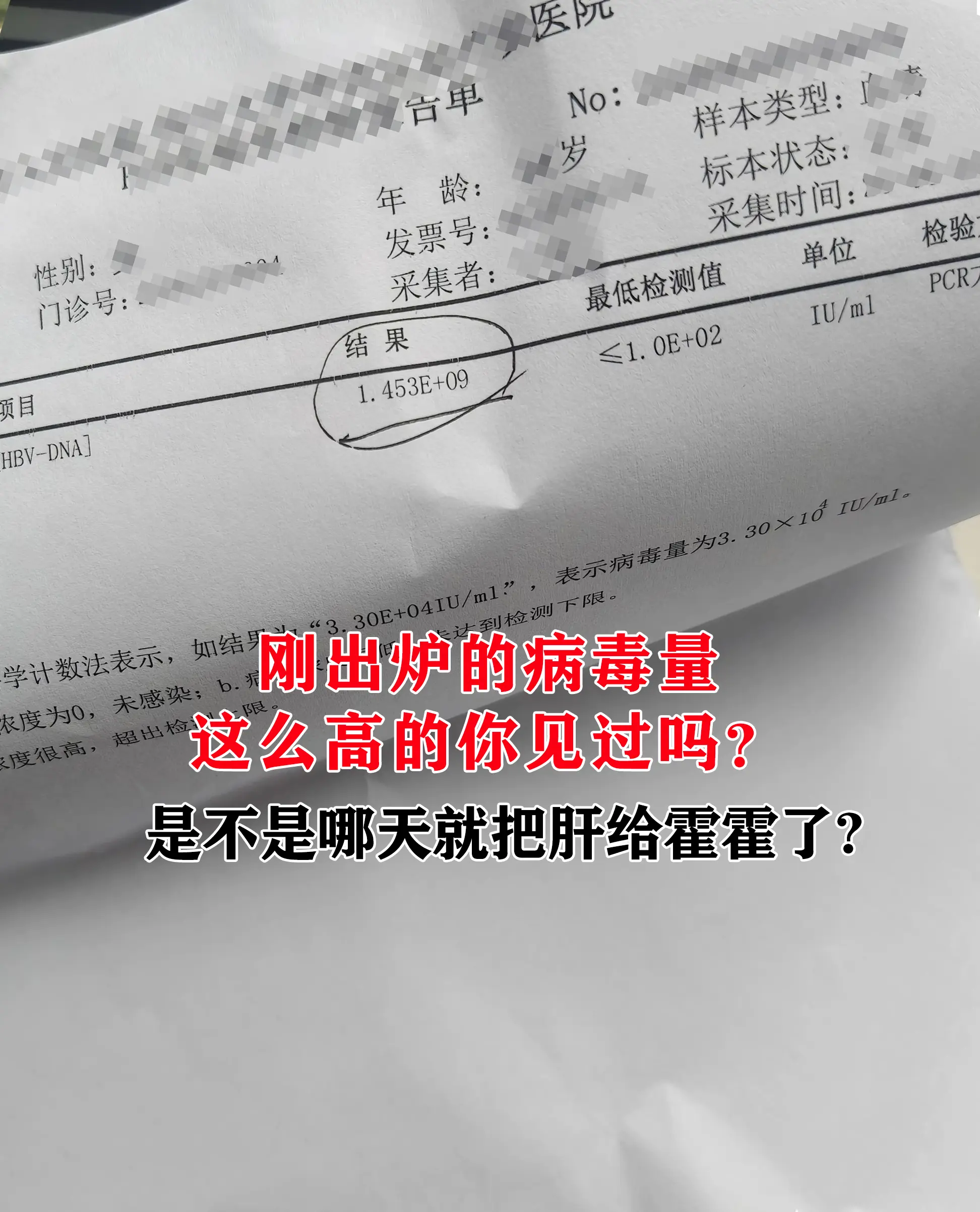 这位朋友，看到你发来的化验单，你这个病毒量确实挺高的，但也不要恐慌。病...