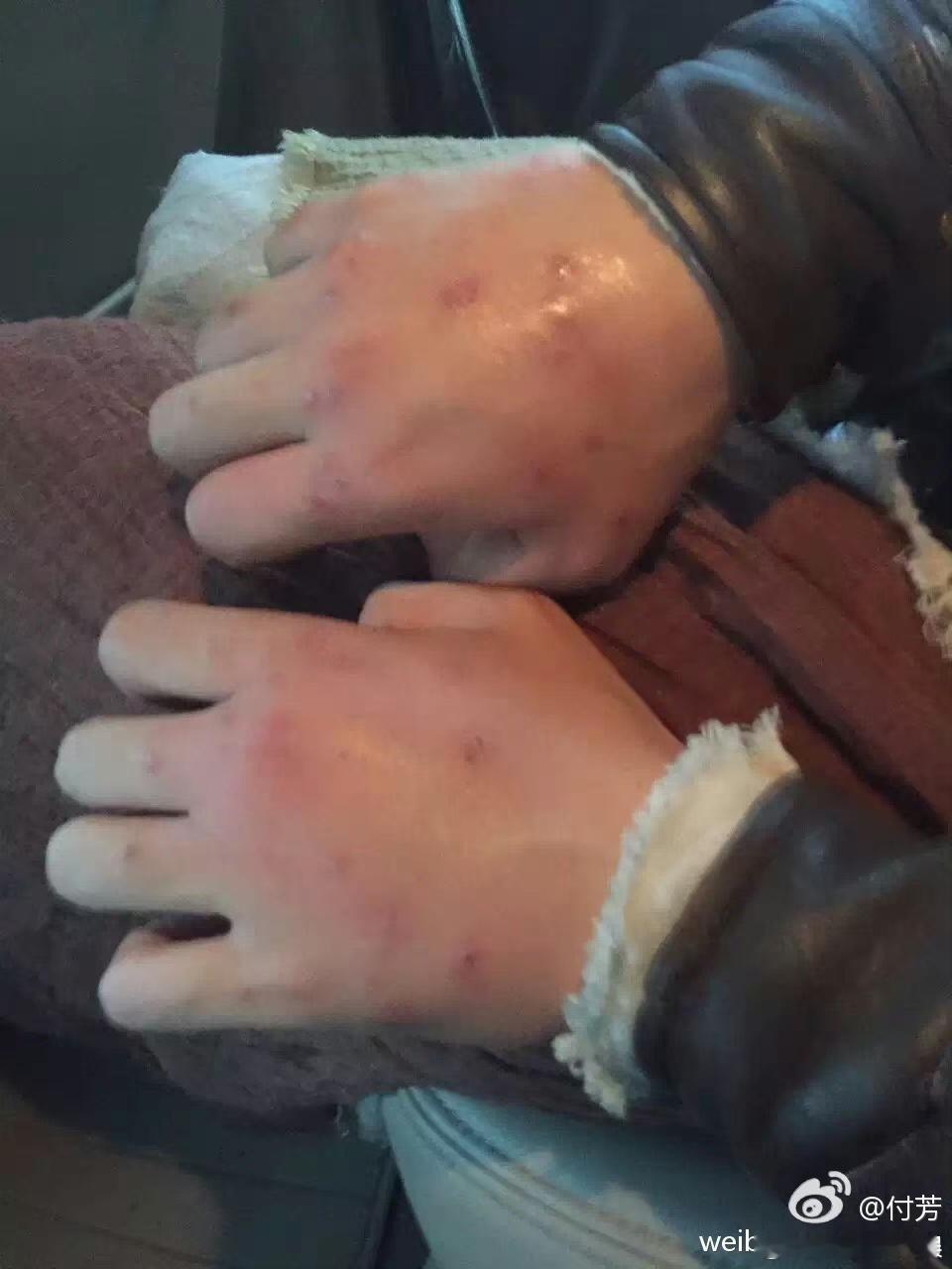 #杨旭文毁容式打戏#杨旭文很有力量感，而且每一次的打击都让我们大家觉得特别的惊喜