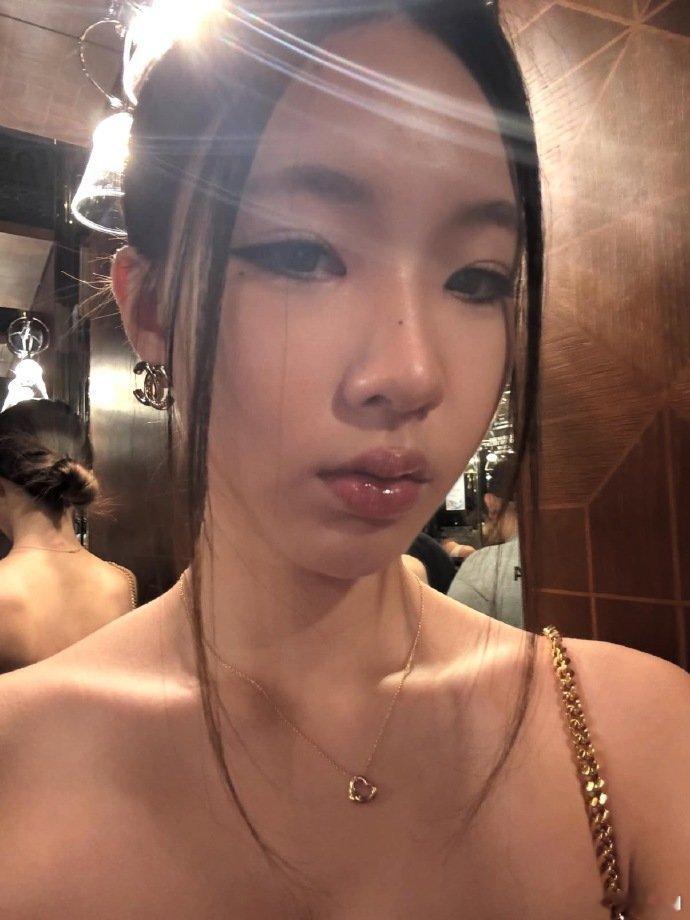 小S大女儿晒面部针灸照 小S大女儿晒近照，这个头骨绝了！ 小S大女儿晒近照