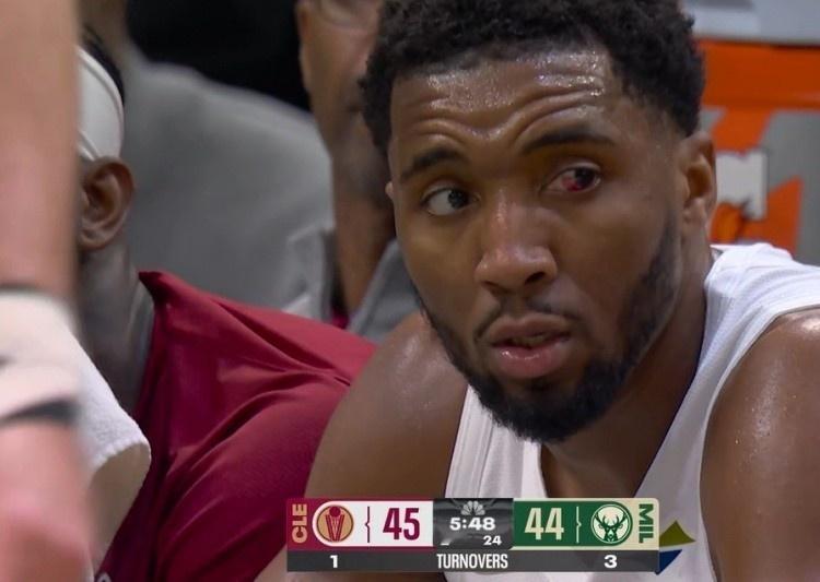 米切尔：“我的左眼几乎看不见了，今晚很艰难，就是这样。但我还是能站上罚球线，还是