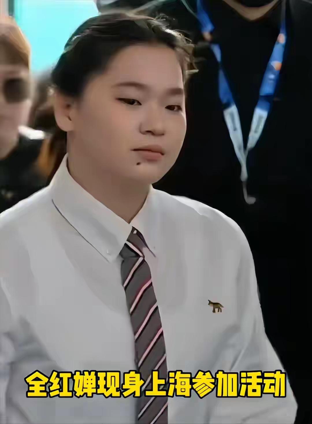 质疑全红婵的人太多了：我为她说2句“公道话”！
发育造成的身体变形，这不是全红婵