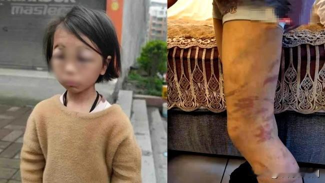 2016年，内蒙有一再婚男子与女儿同住。这天他无意看了一眼女儿的裤子，瞬间火冒三