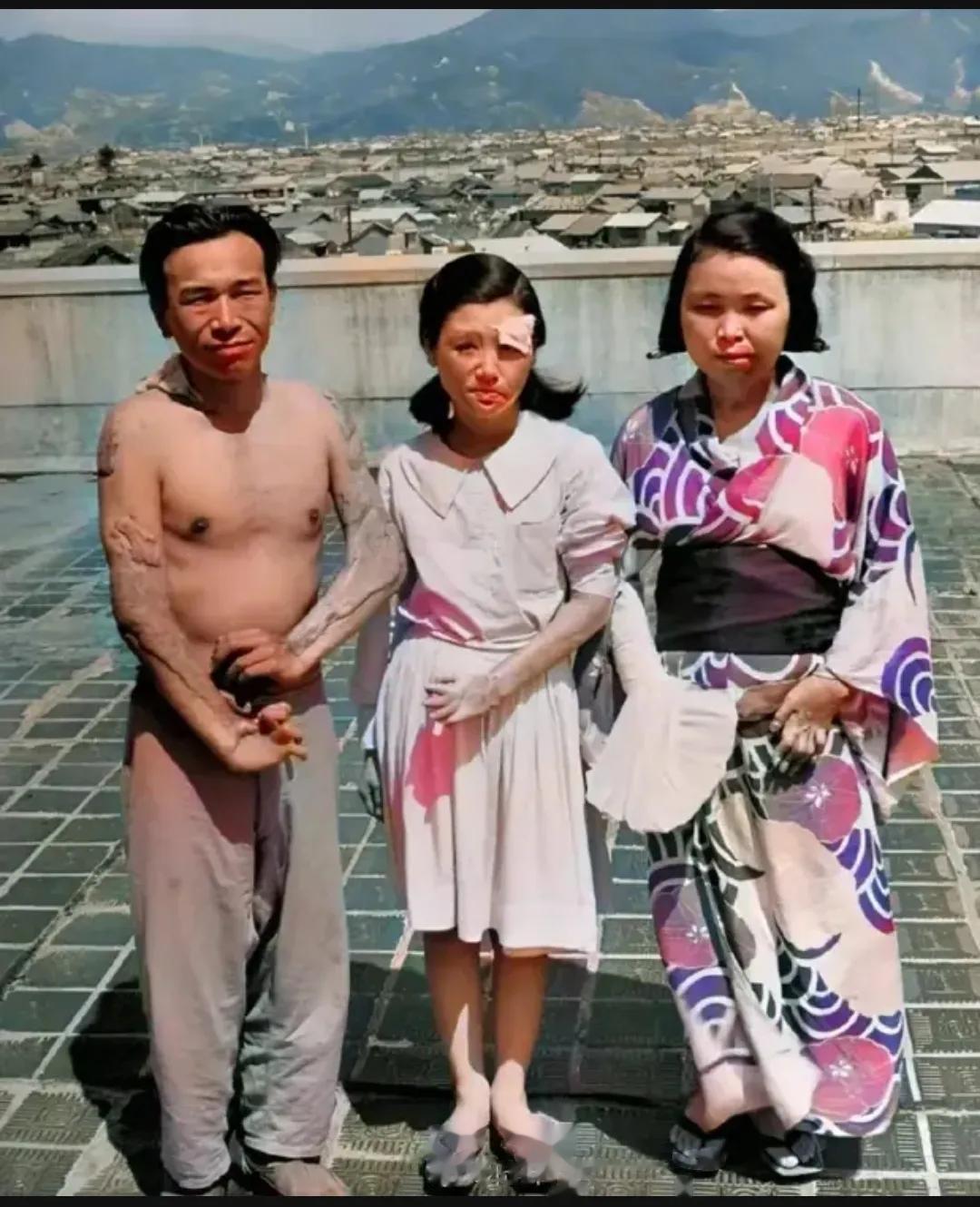 1945年，广岛原子弹爆炸后，幸存下来的日本家庭，留下的一张照片，从镜头里我们可