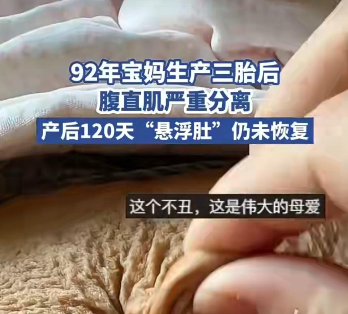 三胎宝妈产后120天悬浮肚未消：这哪是代价 分明是勋章
 
92年广东宝妈生完三