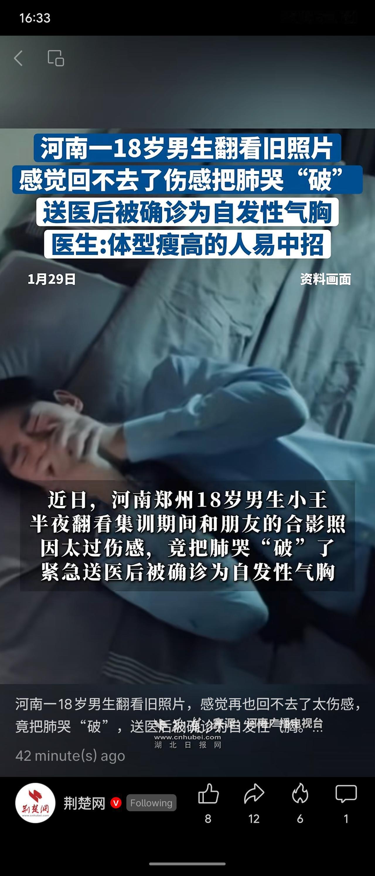 河南郑州一名18岁瘦高男生因翻看旧照情绪激动大哭，诱发自发性气胸，右肺被压缩至仅