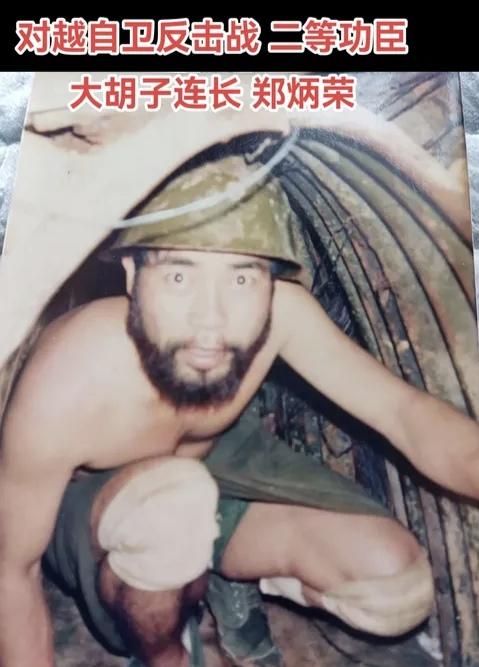 战斗英雄郑炳荣：以血肉守国门，用忠诚铸军魂
 
郑炳荣，是对越自卫反击战，两山轮