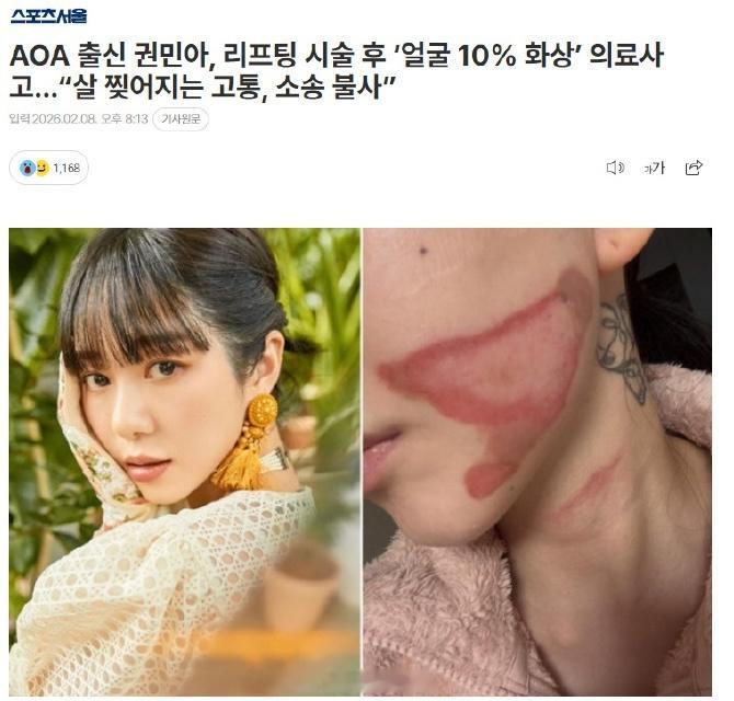 权珉娥做医美导致面度灼伤 据韩媒，权珉娥做了睡眠紧致提拉术，醒来后脸上皮肤撕裂般