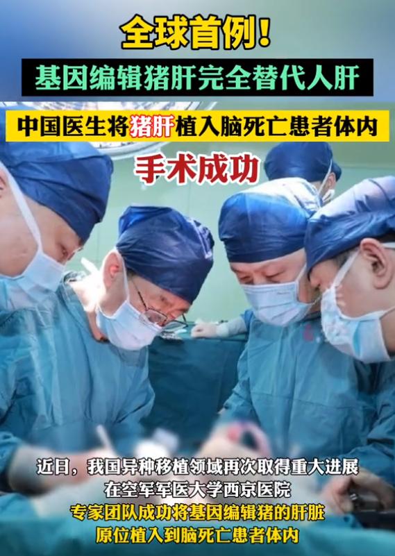 全球首例！中国医生将猪肝植入患者体内，这也是国际上首次实现基因编辑猪肝脏对人体肝