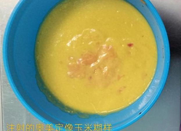 太吓人了，6月25号报道，深圳王女士，因为胸部持续不舒服去医院。结果一查，当年打