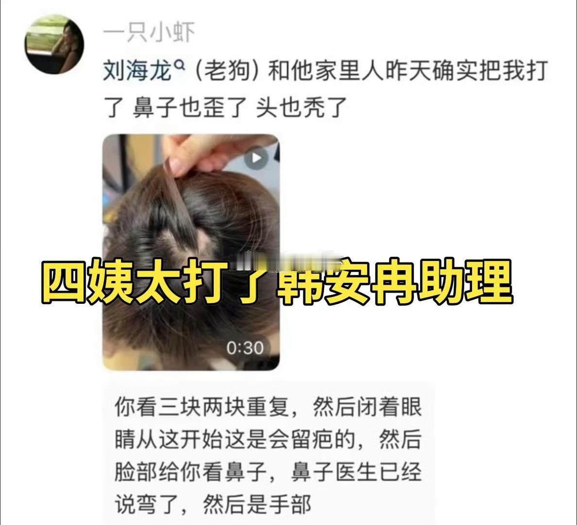 韩安冉谈的这个男朋友把韩安冉助理给打了，鼻子歪了头也秃了！