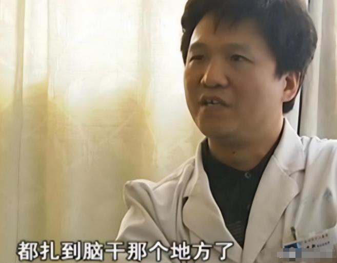 女子踩到一块西瓜皮，被一根长约10厘米的钉子扎进脑袋中。结果医生发现女子的头上只