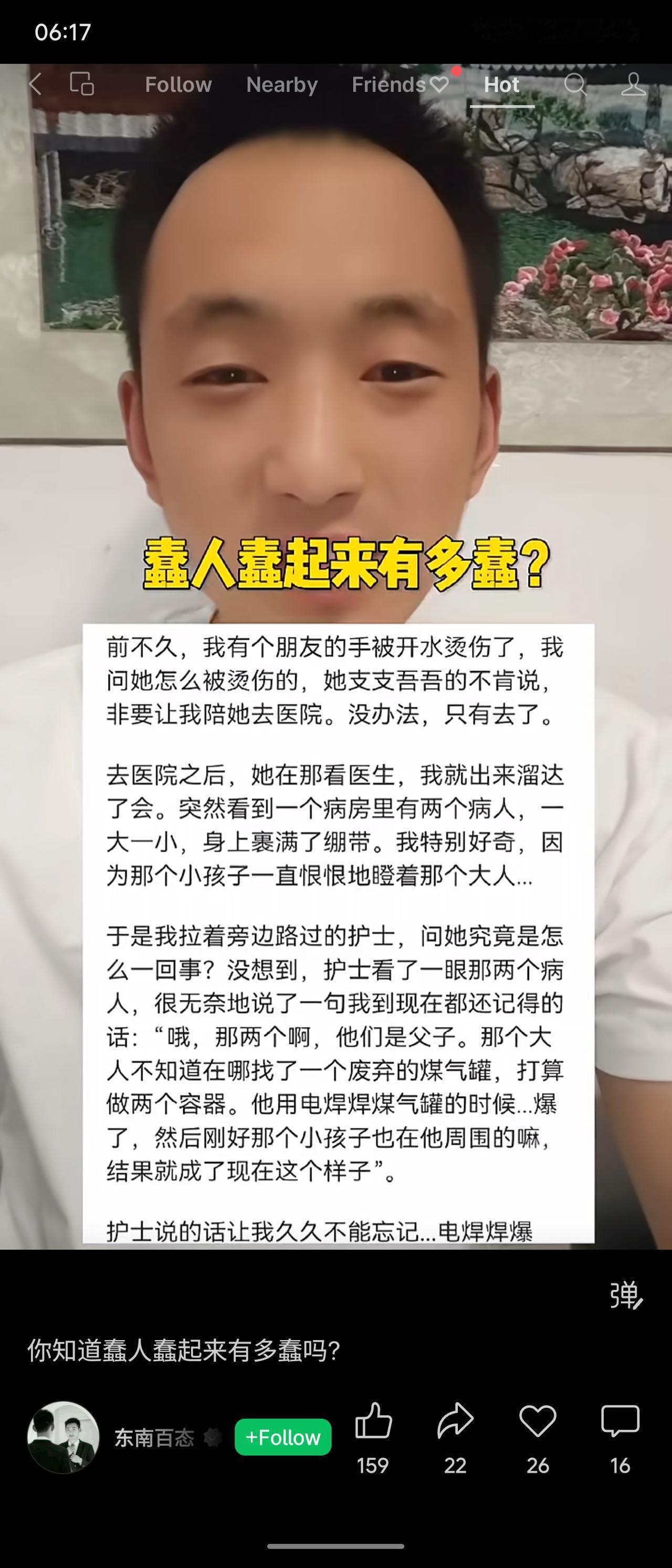 朋友手被烫伤陪她就医，看到病房里一对父子全身裹满绷带。询问得知，父亲想用电焊切割