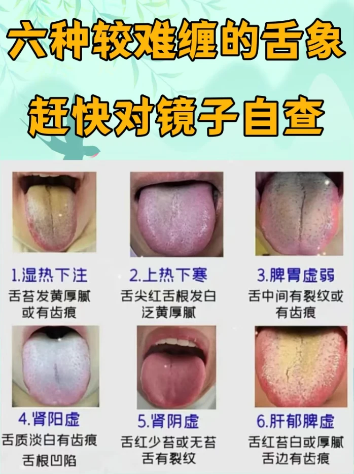 六种难缠舌象，来看看你有没有中招！！！