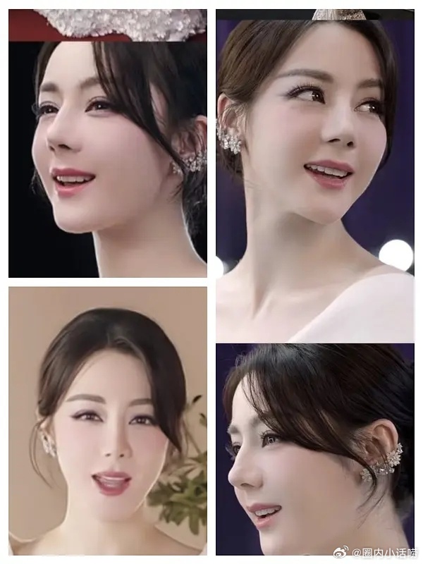 有一说一，迪丽热巴的脸还能恢复吗？ 