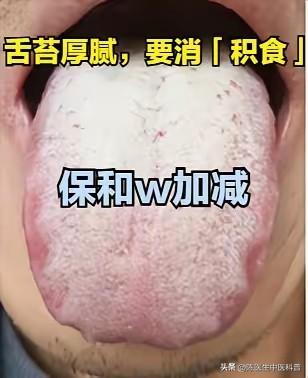 舌苔厚腻＝积食堵了！消食和胃，舌苔马上清爽
 
大家好，我是中医陈大夫！
 
舌
