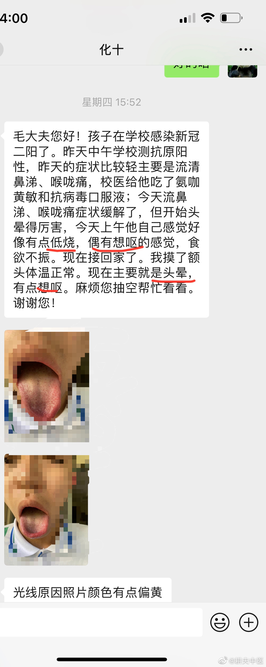 一个小朋友，二阳后，头晕，恶心，少阳夹饮，小柴胡、二陈汤、泽泻汤，吃了效果挺好的