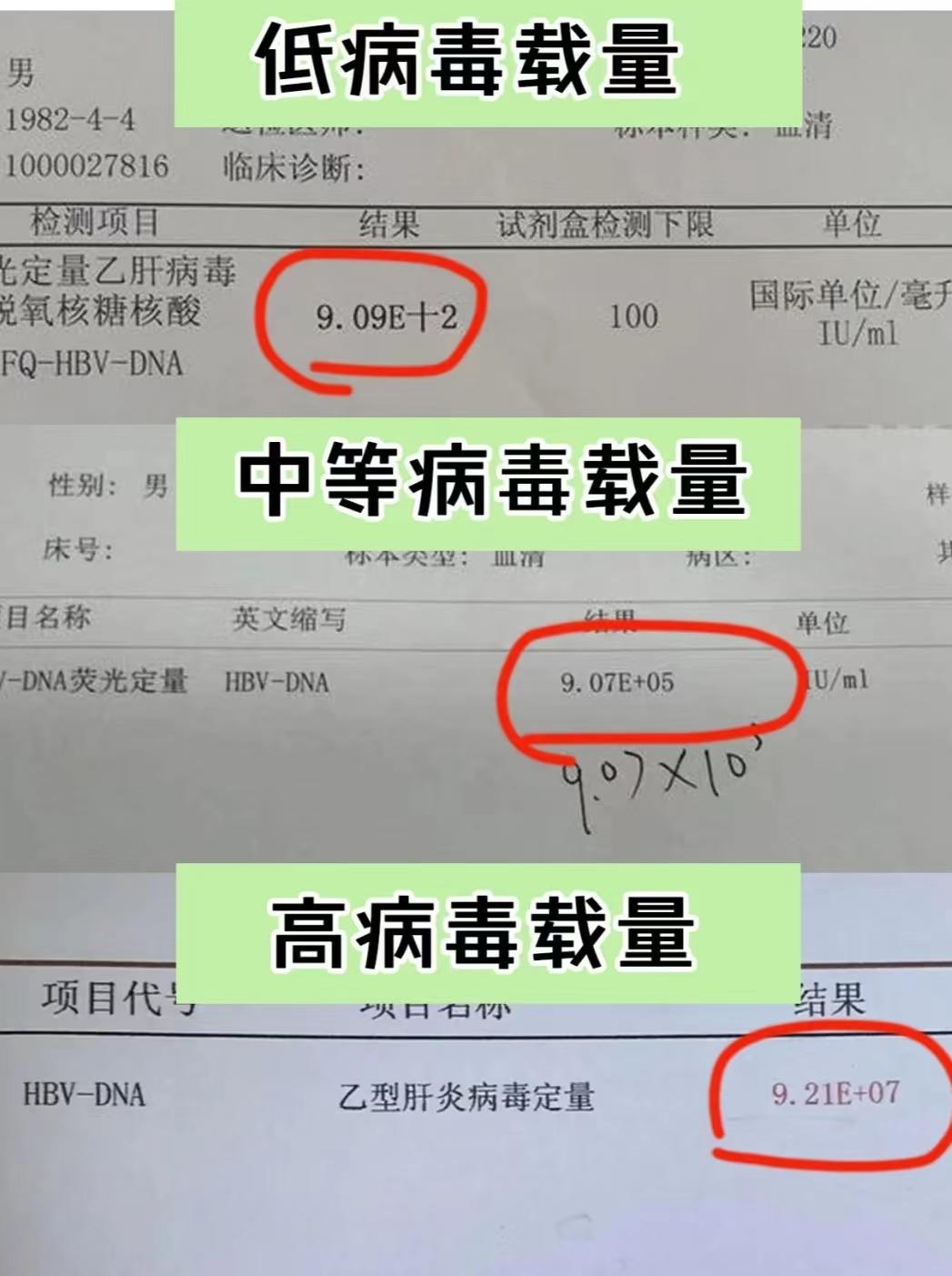 乙肝病毒量多高有危险？
乙肝病毒量划分大致可分3个等级:
1、高复制载量：10的6次方以上;
2、中等复制载量：10的3~10的5次方;
3、低复制载量：10的3次方以下。
想要判断乙肝严不严重，不能光单纯看病毒量高低，要找到专业肝病医生结合生化学指标和影像学报告综合评估！