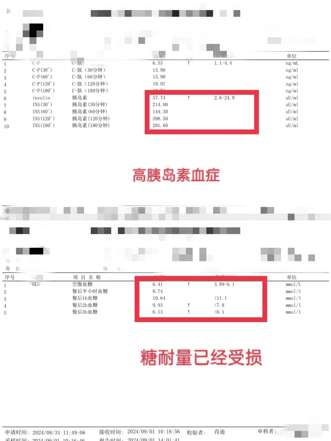 胰岛素抵抗之高胰岛素血症