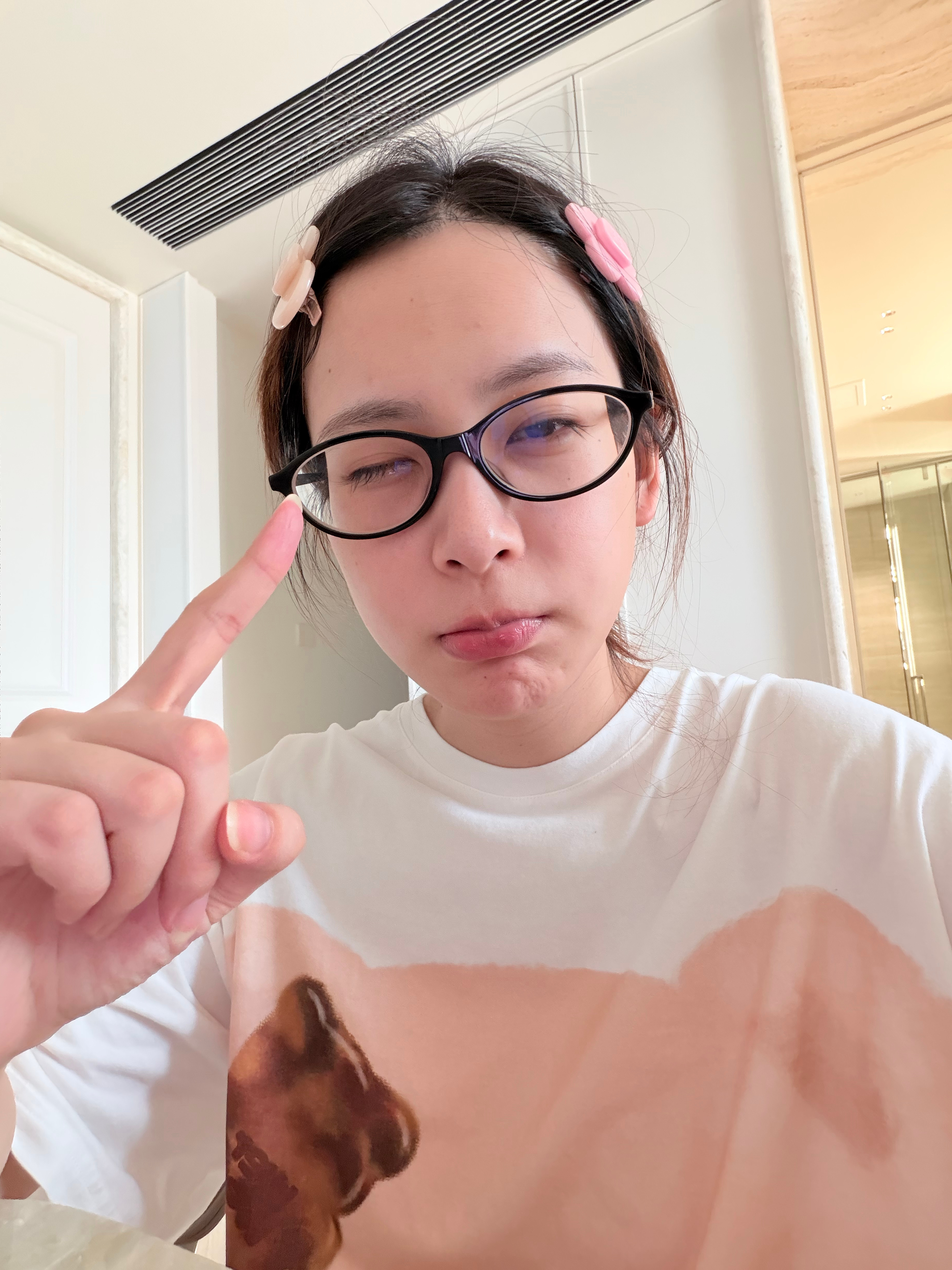 变独眼鹅了昨天开始眼睛疼雾蒙蒙的今天一查细菌感染发炎了 ​​​