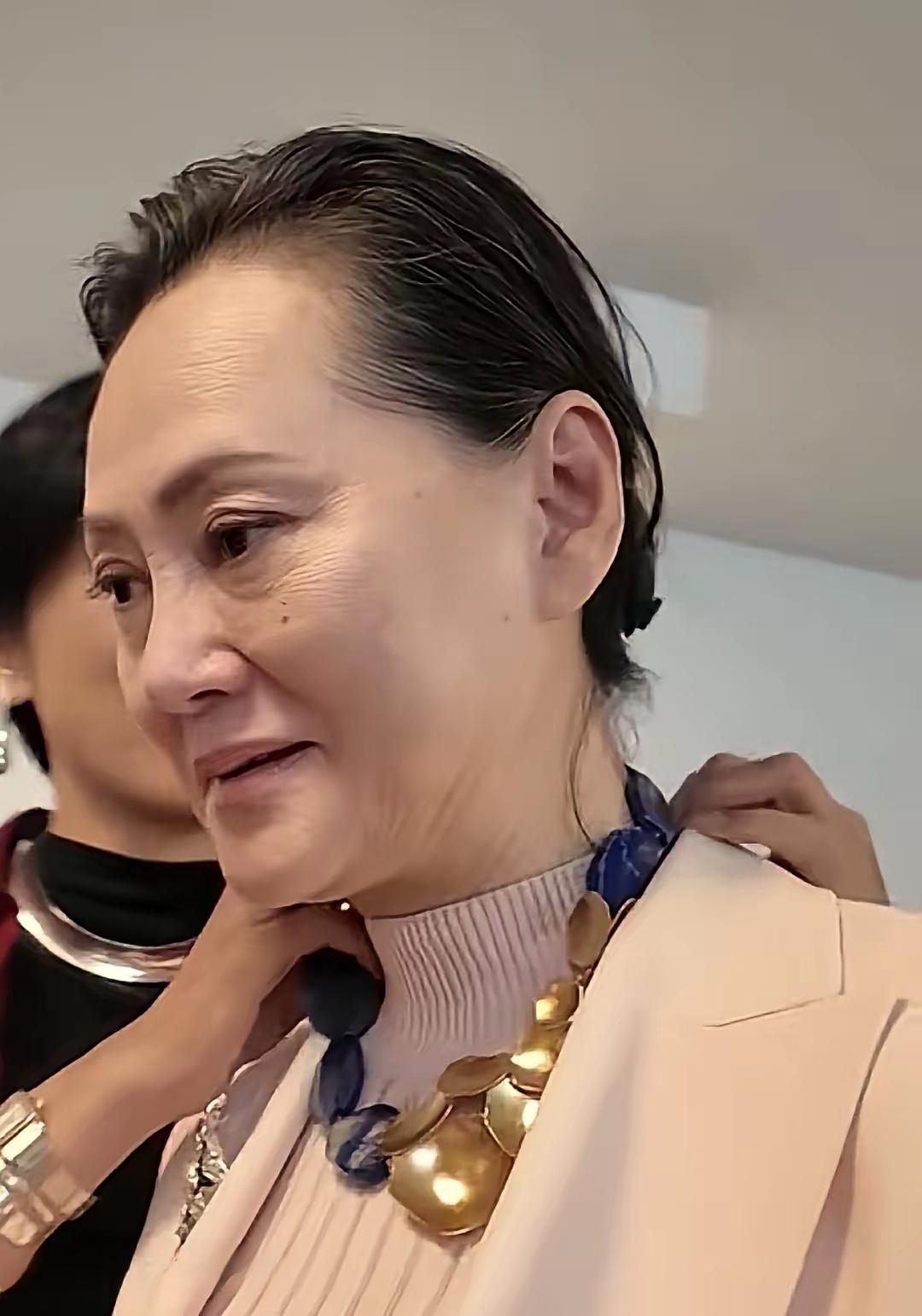 大宋佳，今年63岁了，尽管脸庞圆润，但老态过于明显了，脸上没有了自然光泽，眼角有