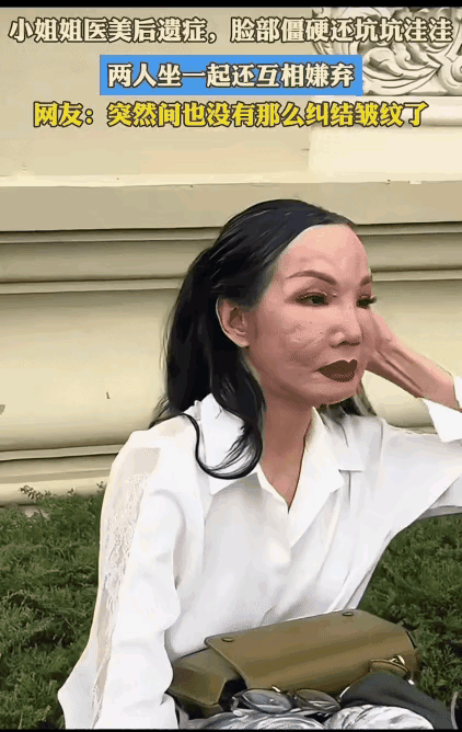 医美效果如此，竟至互相嫌弃。自家容颜交由他人负责，后果是很严重的。