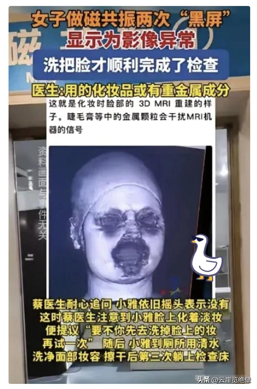 解释不清了！福建一29岁女生头晕，去医院做头颅磁共振。不料，连续2次扫描，都因面